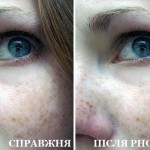 Сльози